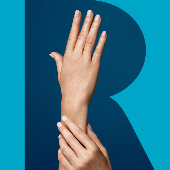 picture of two smooth and wrinkle-free hands showing the results of Radiesse