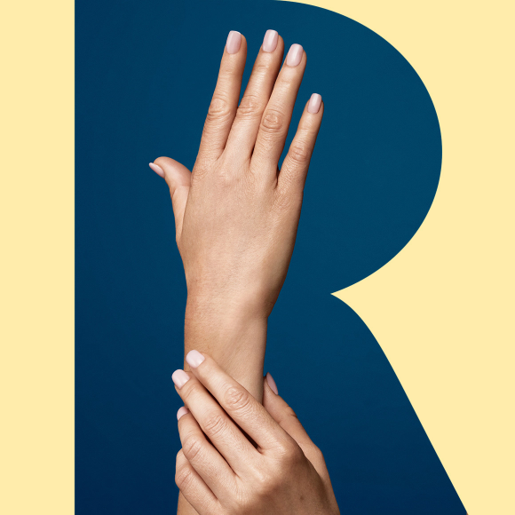 Photo of two hands showing the smooth results of Radiesse